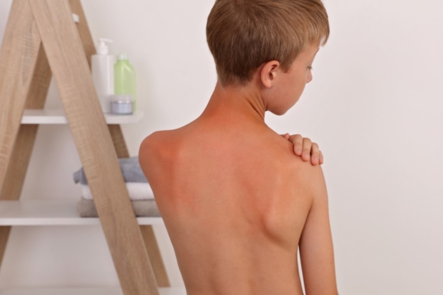 Hidratar la piel de los niños diariamente ayuda a prevenir la sequedad y la irritación.