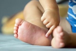 Ropa de algodón o fibras naturales minimiza el riesgo de rozaduras en la piel sensible.