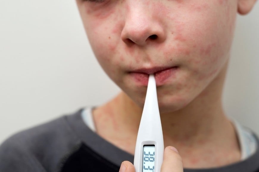 Se estuvieron dando brotes en países vecinos