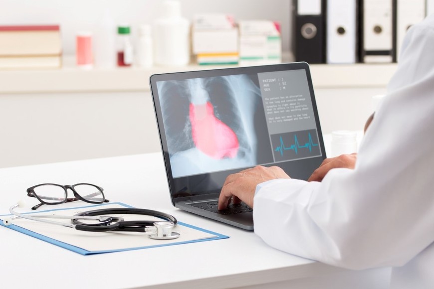 Actividad física y hábitos saludables, aliados para cuidar la salud cardiovascular.