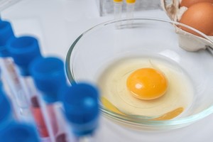 Un total de 95 casos en 14 estados fueron confirmados con la misma cepa,