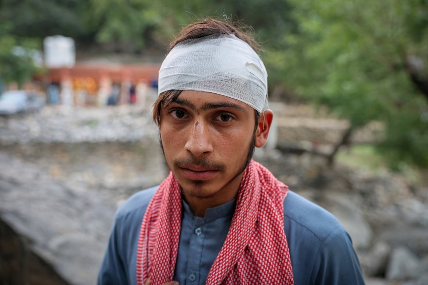 An injured Afghan man sits after getting firstaid after a deadly magnitude-6 earthquake that struck Afghanistan around midnight, in Dara Noor, in Jalalabad, Afghanistan, September 1, 2025. REUTERS/Sayed Hassib