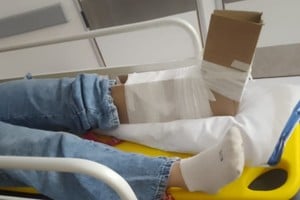 La joven ciclista recibió las primeras atenciones en plena Ruta 1.