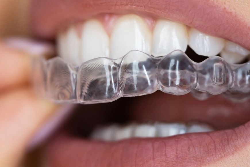 Placa para descanzar