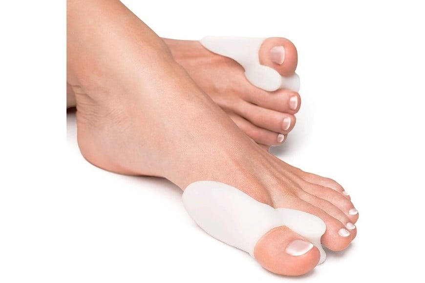 El tratamiento depende de la gravedad de la malformación