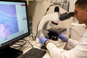 La innovación científica está transformando el panorama de la oncología.