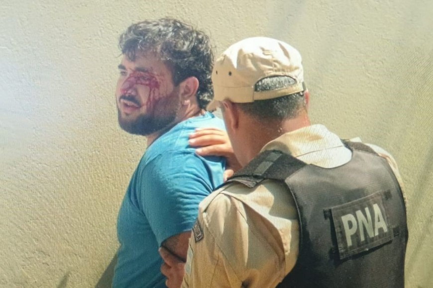 Uno de los sospechosos estaba lastimado en el momento del arresto. Foto: Gentileza C&D