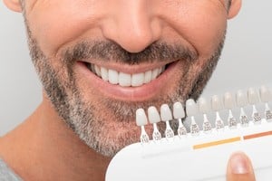 Diversos alimentos y bebidas pueden alterar el color de los dientes y dañar el esmalte.