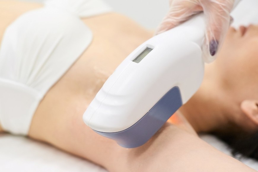 Equipo estético sin procedencia verificada