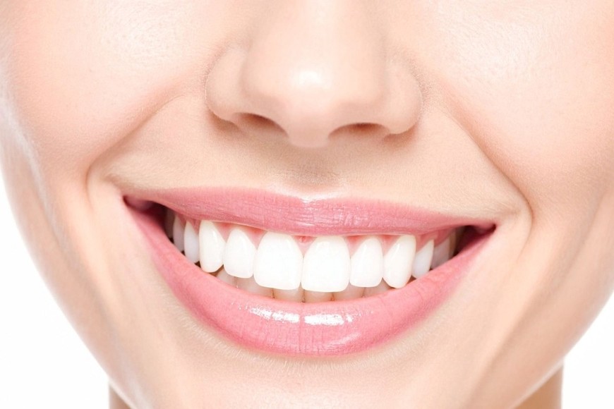 El blanqueamiento profesional aclara varios tonos