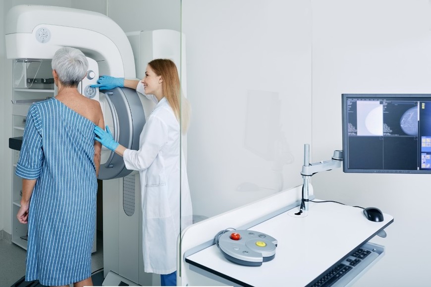 Mamografías anuales ayudan a detectar el cáncer de mama a tiempo.