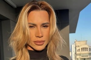 El influencer y estilista había decidido someterse a una cirugía estética