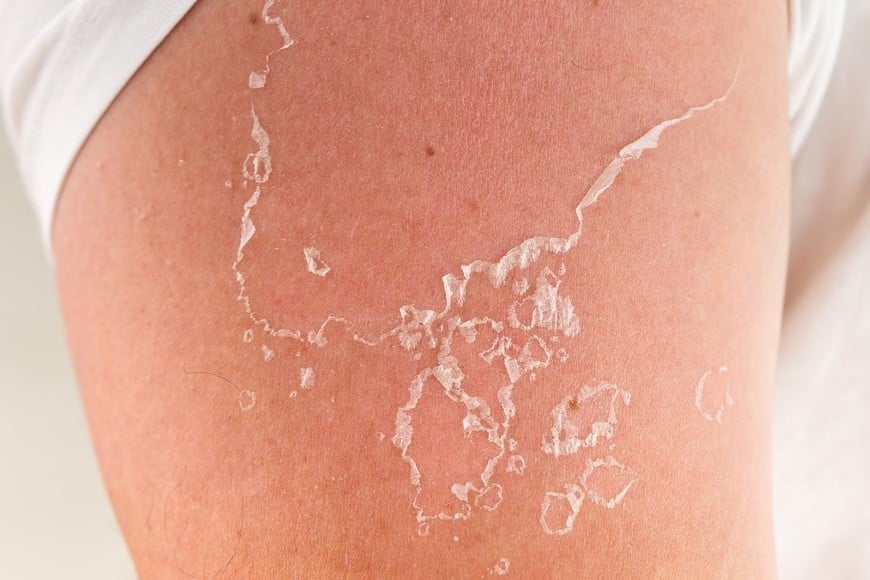 No cuidarse implica riesgos concretos que no deben minimizarse.