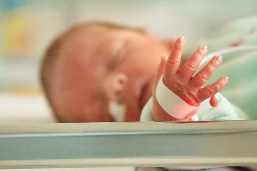 Puede haber una cirugía en un recién nacido.