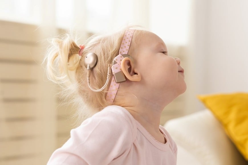 Hasta ahora, la principal solución para estos casos eran los implantes cocleares,