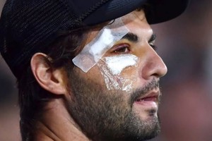 Su baja es una de las más sensibles para el equipo de Gustavo Costas.