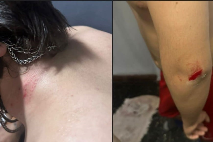 pelea perros santo tomé