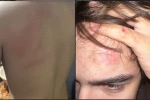 Algunas de las lesiones que sufrió el adolescente. Foto: Gentileza