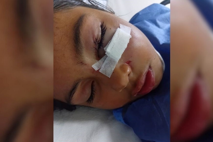 Santa Fe: una nena de 8 años fue atacada por un pitbull en el rostro en barrio Los Hornos - Image 3