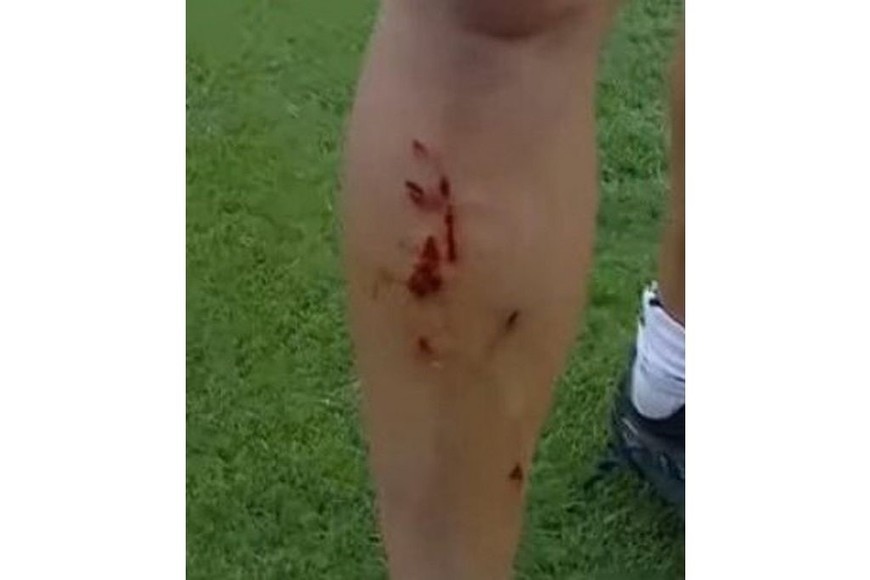 El partido entre Deportivo Madryn y Deportivo Morón terminó en un batalla campal.