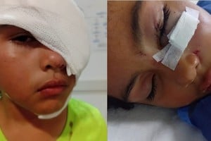 niña mordida por un pitbull en barrio Los Hornos