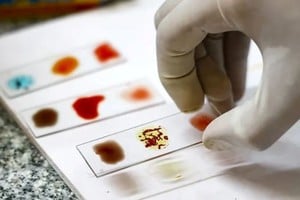 Solo una de cada seis millones de personas tendría la "sangre dorada" y se estiman alrededor de 50 individuos con ese fenotipo en el mundo.