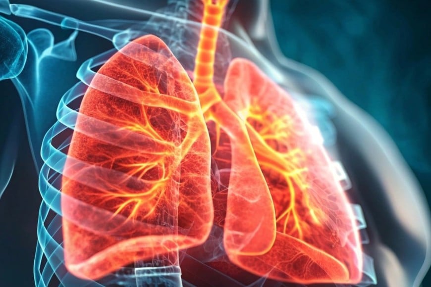 Las causas más habituales son la exposición prolongada a humo de tabaco, gases irritantes, polvo o sustancias químicas.