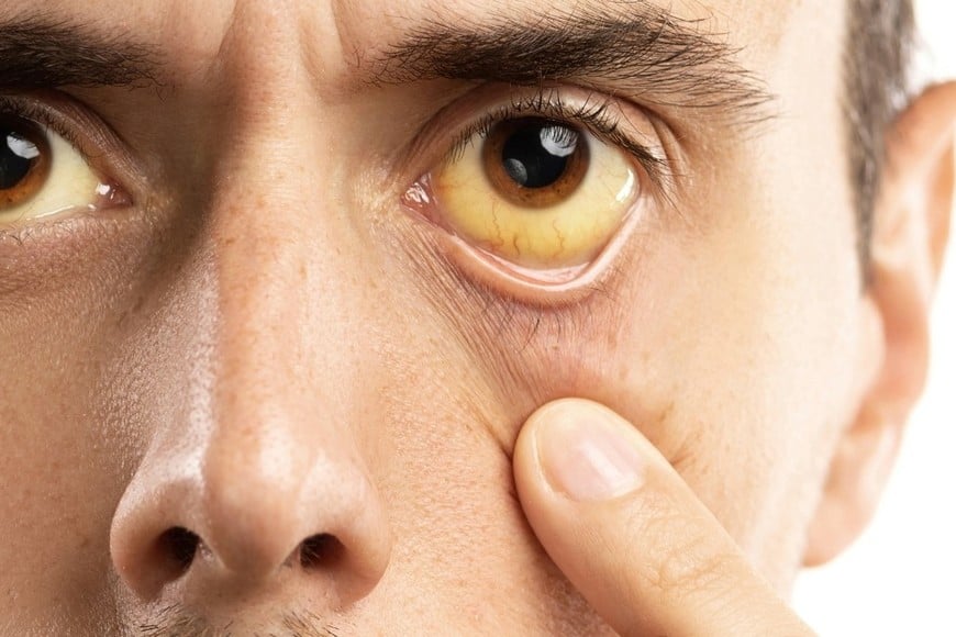 Palidez o piel amarillenta