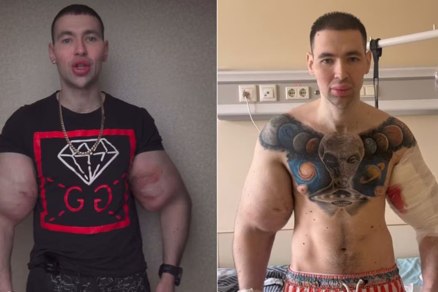 Kirill Tereshin, el influencer ruso conocido como el “Popeye ruso”.
