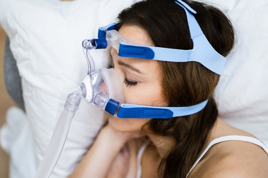 El diagnóstico clásico de Apnea obstructiva del sueño (AOS) se realiza mediante estudios de sueño