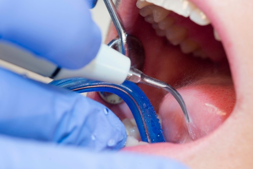 Productos de uso odontológico que estaban siendo comercializados con datos falsos o certificados vencidos.