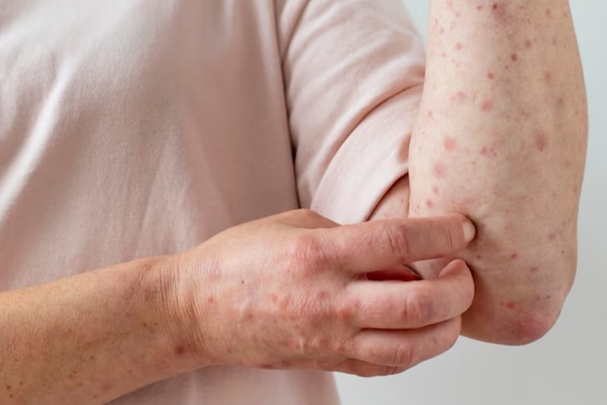 Salud nacional refuerza el llamado a completar esquemas de vacunación.