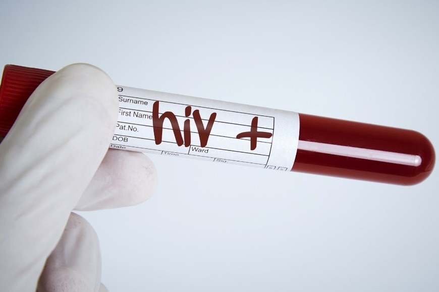 VIH/ sida