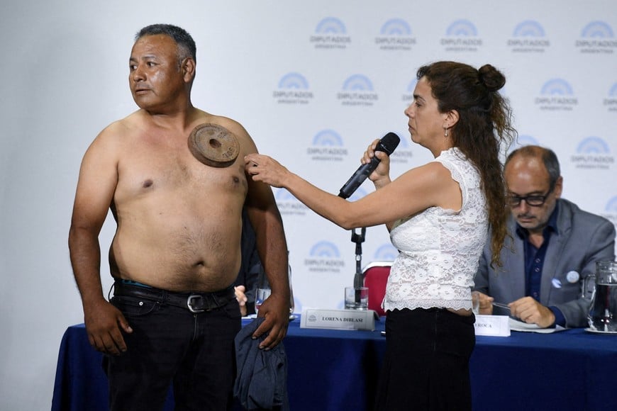 Jose Daniel Fabian demonstrates a metal weight sticking to his chest, as biotechnologist Lorena Diblasi speaks during an anti-vaccine panel, where they claim that "magnetization" occurred after receiving a COVID-19 vaccine, at the National Congress, in Buenos Aires, Argentina, November 27, 2025. Fotografia Diputados/Handout via REUTERS    THIS IMAGE HAS BEEN SUPPLIED BY A THIRD PARTY.  NO RESALES. NO ARCHIVES