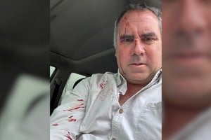 Rafael Belaúnde Llosa con con el rostro ensangrentado tras el ataque en Cerro Azul