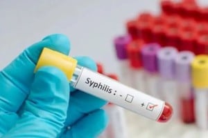 La Provincia mostró una baja aproximada del 6 % en casos detectados respecto del mismo período del año anterior.