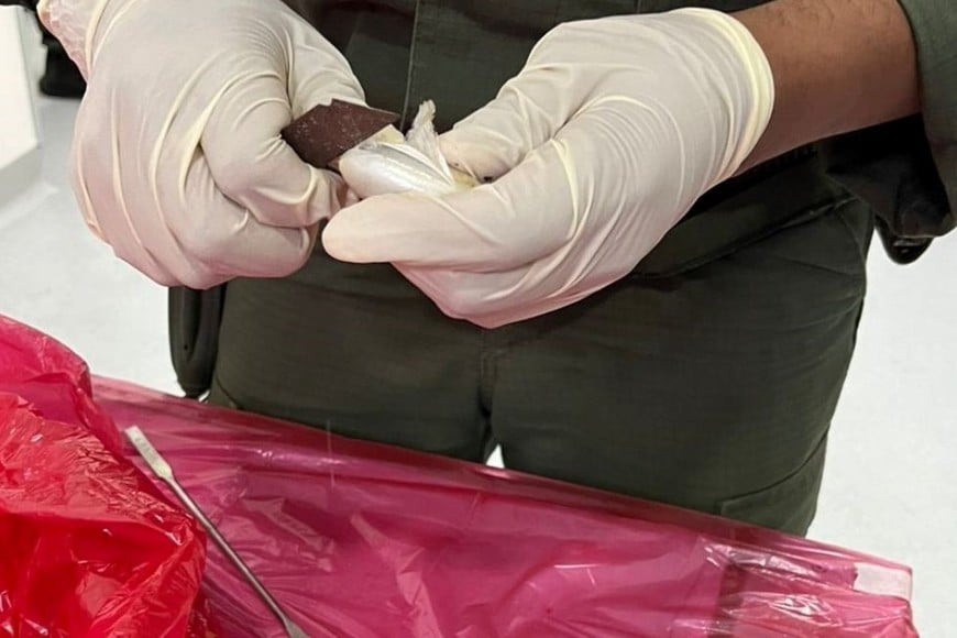 Inspección de una de las cápsulas con cocaína. Foto: Gentileza