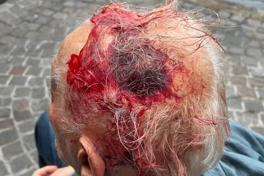 La pareja fue atacada en la puerta de su casa en Los Acantilados, al sur de Mar del Plata.