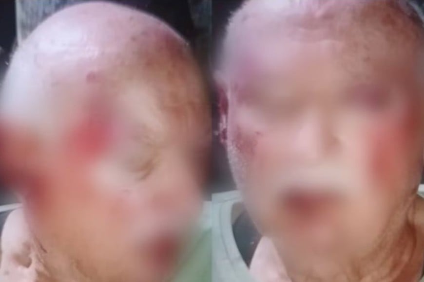 La pareja fue atacada en la puerta de su casa en Los Acantilados, al sur de Mar del Plata.