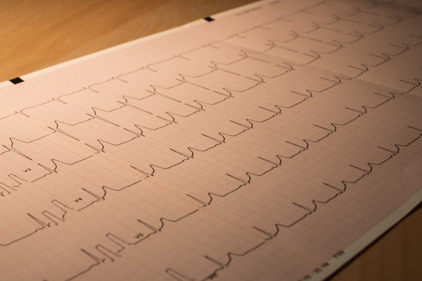 La puntuación CAC-DAD demostró ser más precisa y efectiva que el sistema tradicional