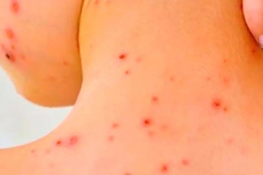 Entre Ríos atraviesa una nueva fase de alerta epidemiológica