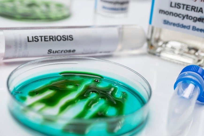 La listeria puede sobrevivir a bajas temperaturas y representar un riesgo para la salud.