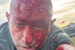 Arsen Ostrovsky se encontró en el centro de un ataque terrorista.