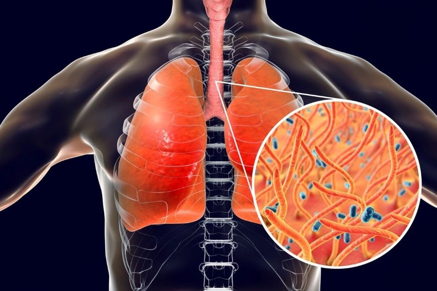 El reporte remarcó que la vacunación continúa siendo la principal medida de prevención.