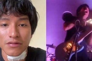 Se electrocutó en pleno show y sobrevivió: “No terminó en tragedia por suerte”