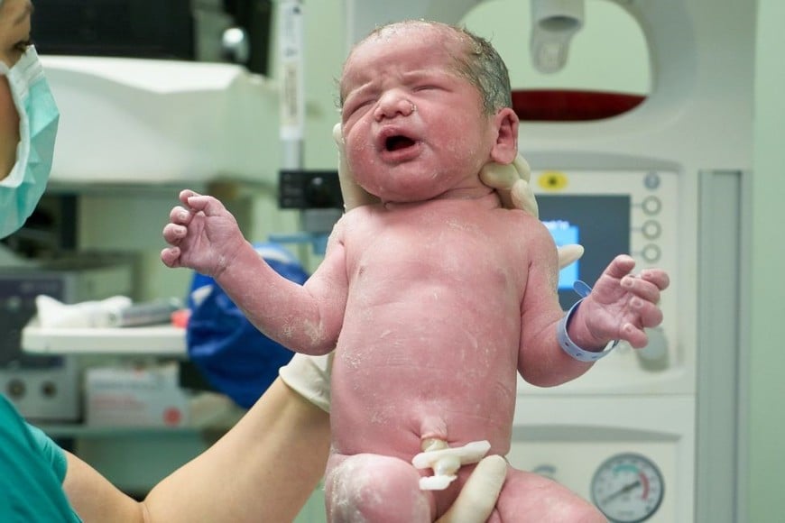 En el sector privado cerca de ocho de cada diez partos son por cesárea