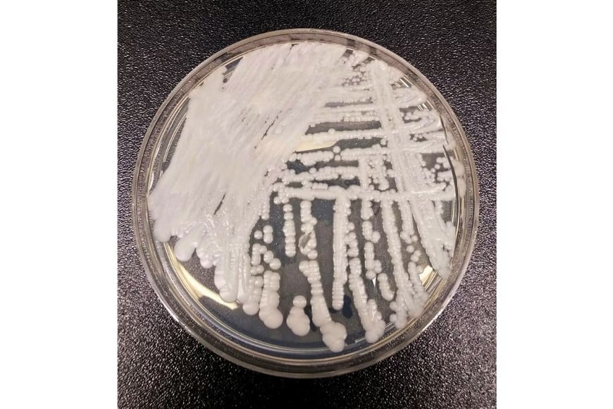 El hongo Candida auris, considerado uno de los patógenos emergentes más preocupantes