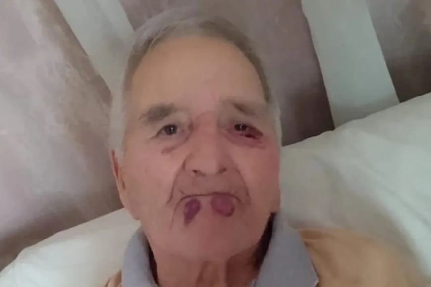 La fiscalía investiga la agresión sufrida por el hombre de 89 años en Mar del Plata.