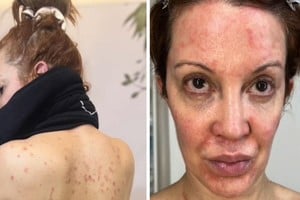 Imágenes impactantes y su descargo en redes: el año más difícil de Miriam Lanzoni.