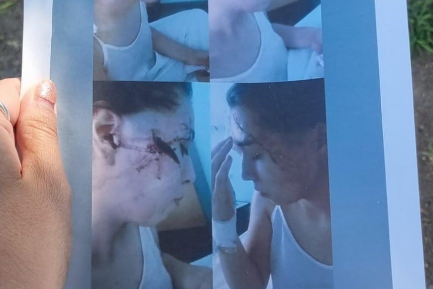 Joven brutalmente agredida en San Cristóbal: nuevo pedido de justicia y la investigación en marcha